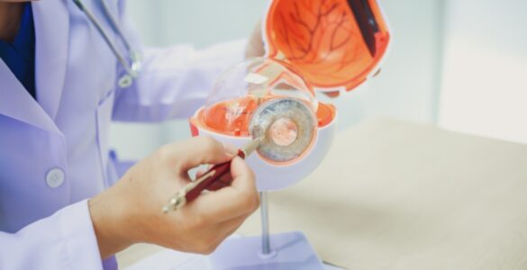 Retinopatia diabética pode comprometer a visão