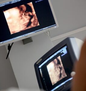 Pesquisa reforça técnica fetal para hérnia diafragmática