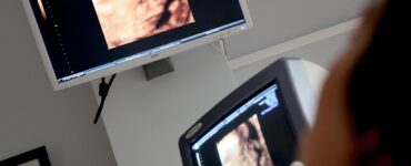 Pesquisa reforça técnica fetal para hérnia diafragmática