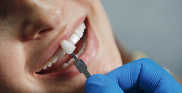 Falha em tratamento dentário nem sempre indica erro