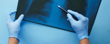 CONITEC abre consulta para Hipertensão Arterial Pulmonar