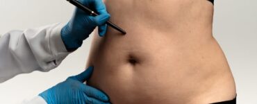 Lipoaspiração lidera preferência por cirurgias plásticas