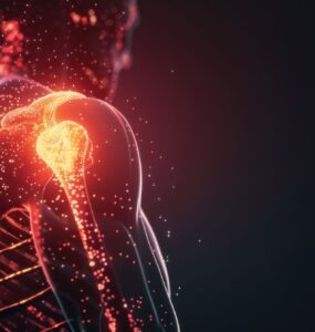 Novos procedimentos tratam a dor no ombro sem cirurgia