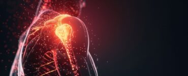 Novos procedimentos tratam a dor no ombro sem cirurgia