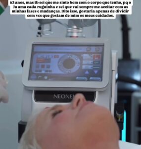 Laser de CO2 Neoxel ganha destaque com Xuxa
