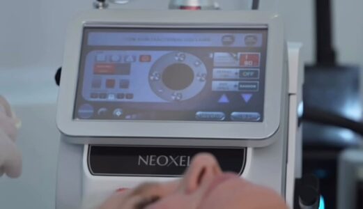 Laser de CO2 Neoxel ganha destaque com Xuxa
