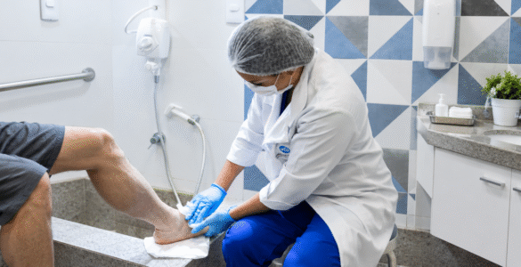Tratamento da erisipela deve começar nos primeiros sinais