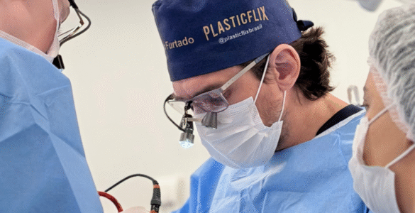 Rinoplastia individualizada valoriza características faciais