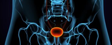 Urologista explica diferenças entre HPB e câncer de próstata