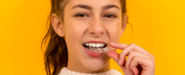Alinhador invisível: como funciona o tratamento dentário
