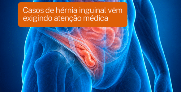 Casos de hérnia inguinal vêm exigindo atenção médica