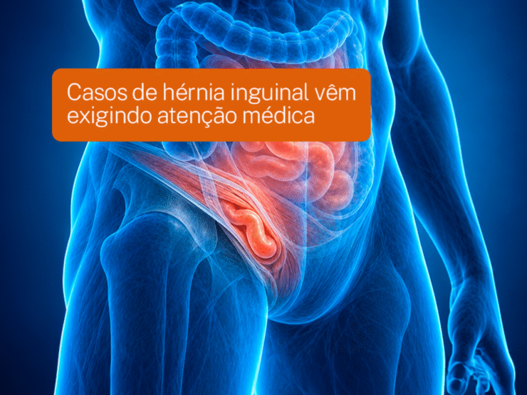 Casos de hérnia inguinal vêm exigindo atenção médica