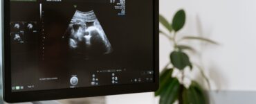 Vilo corial tem diagnóstico genético precoce