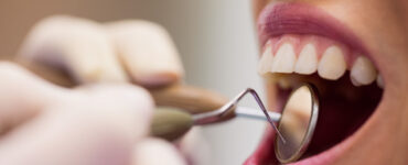 Sangramento na gengiva pede avaliação, alerta dentista